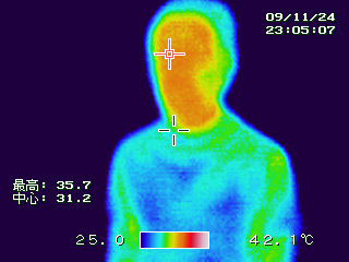 被験者Ｂ　未装着　顔面　体温35.7℃