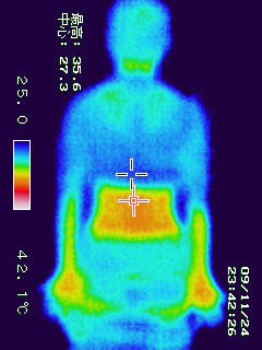 被験者Ｂ　腰痛ニューシステム　背中　体温35.6℃