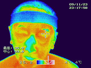 Ｂ：普通のヘアーバンド装着　顔面体温　35.9℃