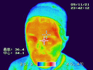 Ｃ2：整体バンド＝頭骨クリアシステムのヘアバンド装着　経過3　　顔面体温　36.4℃